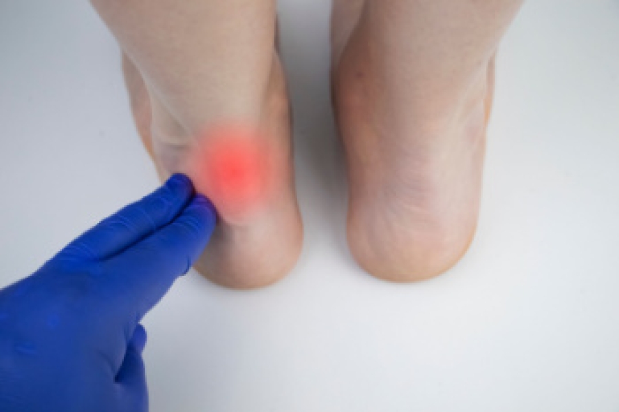 The Achilles Tendon and Tendinitis dlvr.it/TRGPG2