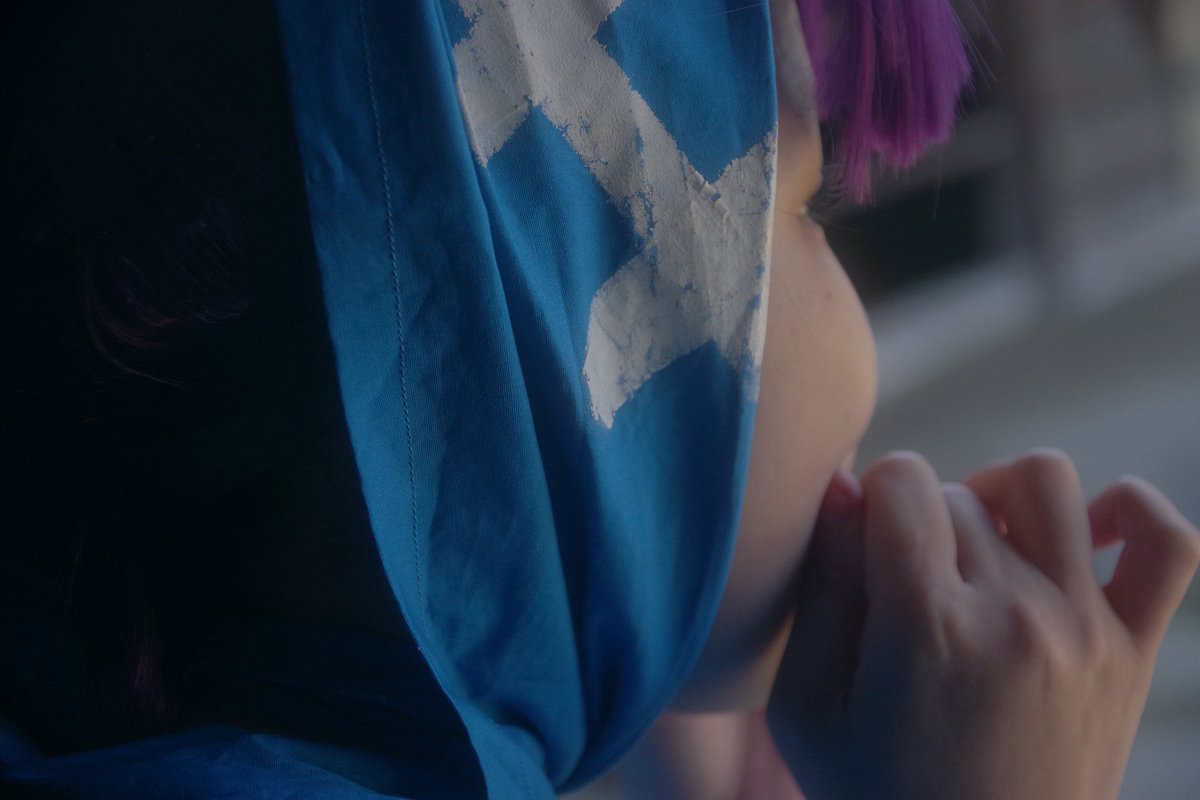 えけちゃんと言われた写真。この頬どうしたら消えますかwww