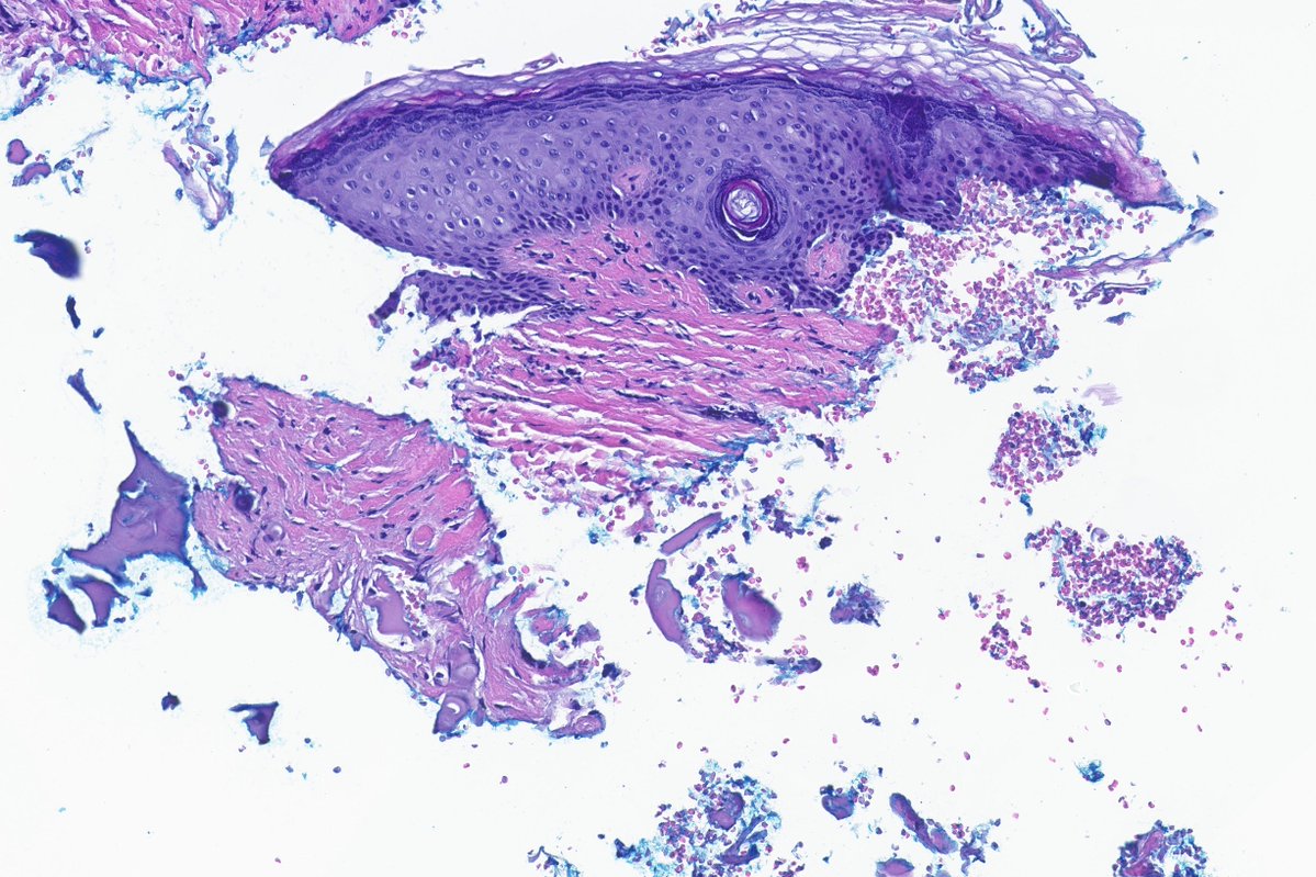 A. Sarah Erem tweet media