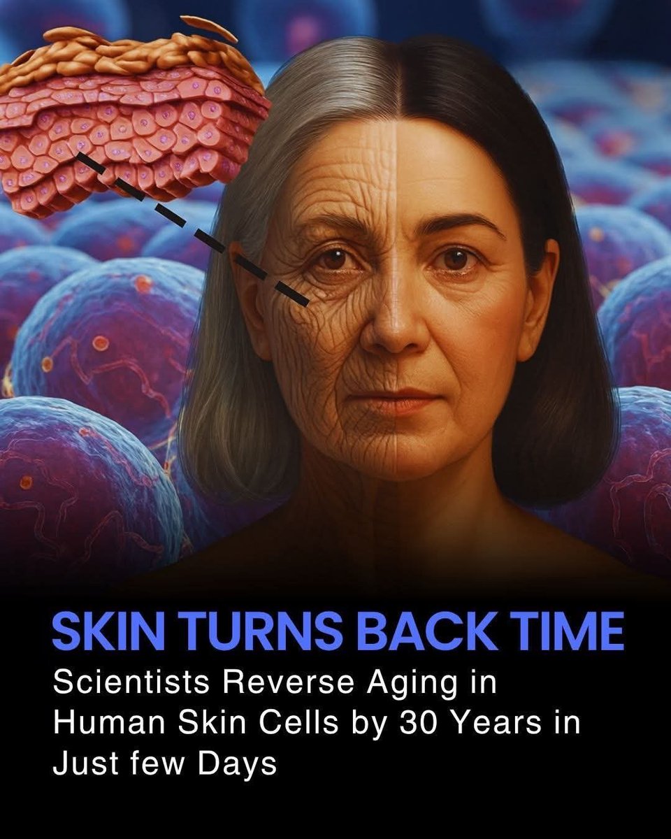 NextScience's tweet photo. 🚨 In a stunning breakthrough, scientists have discovered a method to reverse aging in human skin cells by up to 30 years in just few days. This revolutionary technique could transform the fields of anti-aging, skincare, and regenerative medicine.

The researchers used advanced cellular reprogramming methods to rejuvenate skin cells, effectively restoring them to a much younger state. The process repairs DNA damage, enhances cellular function, and resets the skin’s biological clock, making cells behave like they did decades earlier.

This discovery holds enormous potential for developing future therapies that combat the visible signs of aging, improve skin health, and even reduce age-related cellular decline. By targeting the root causes of cellular aging rather than just the symptoms, scientists are opening a new era in longevity research.

Experts say that while this research is still in its early stages, it demonstrates that age reversal at the cellular level is possible and could eventually lead to breakthrough treatments for humans, not just in skincare but potentially for broader regenerative medicine applications.