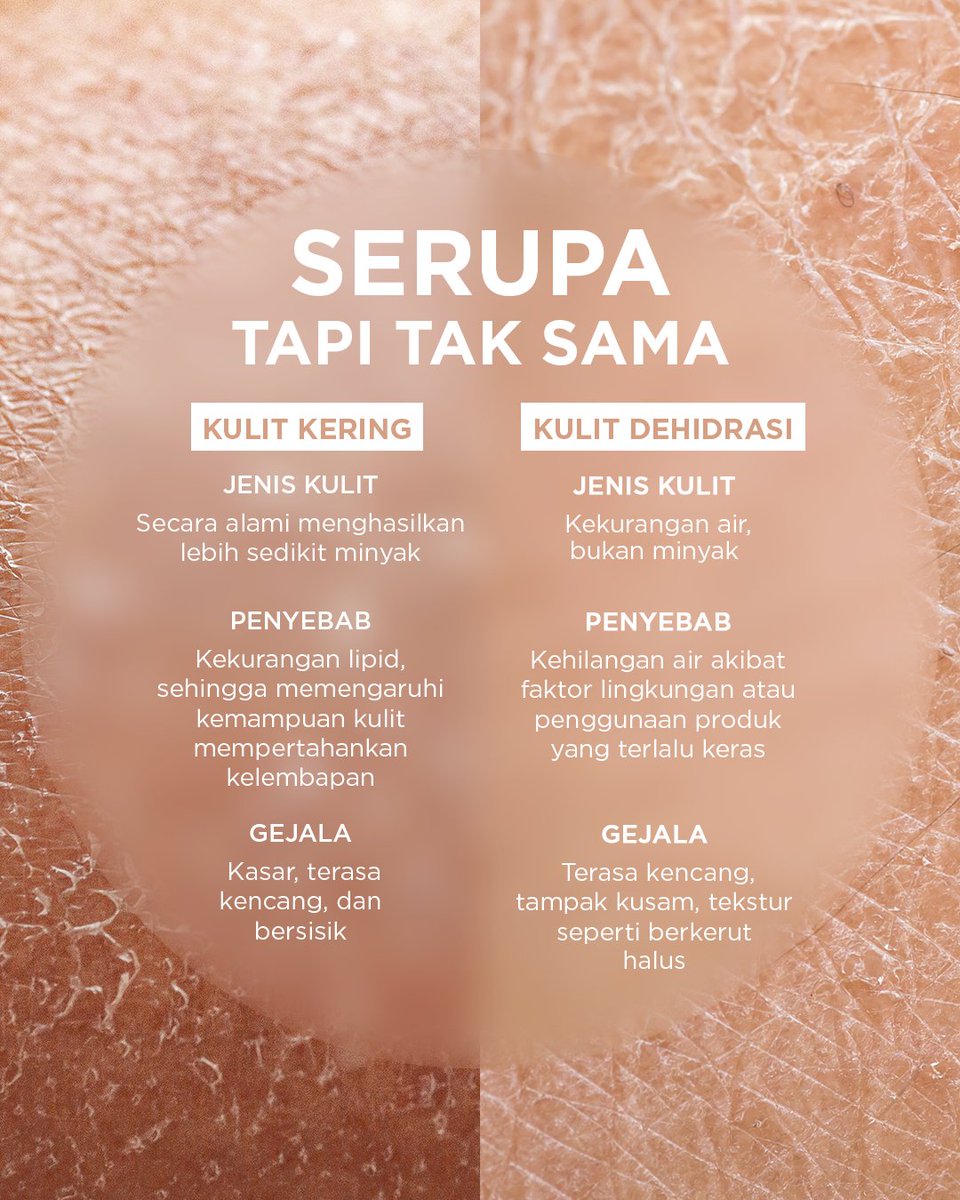 Bioderma_ID's tweet photo. Treat dry skin &amp; dehydrated skin right.
Cleanse with Sensibio H2O / Gel Moussant.
Nourish with Atoderm Huile de Douche.
Hydrate with Hydrabio Hyalu+ Serum.
Protect with Photoderm Spot-Age SPF50+.
Balanced skin starts with the right care. 
#YourRealSkinUpgrade #biodermaindonesia https://t.co/4D4sJXzS4S