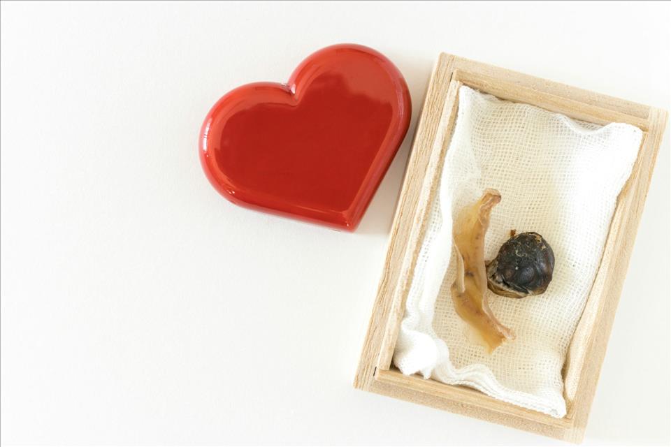 MENAFN's tweet image. From Kneecap Necklaces To Umbilical Cord Keepsakes: The Risks Of Keeping And Consuming Human Tissue #Kneecap #Necklaces #Umbilical #Cord #Keepsakes: #Risks #Keeping #Consuming #Human #Tissue #Cinema #Music #Movie #Disney #Netflix dlvr.it/TRGS0z