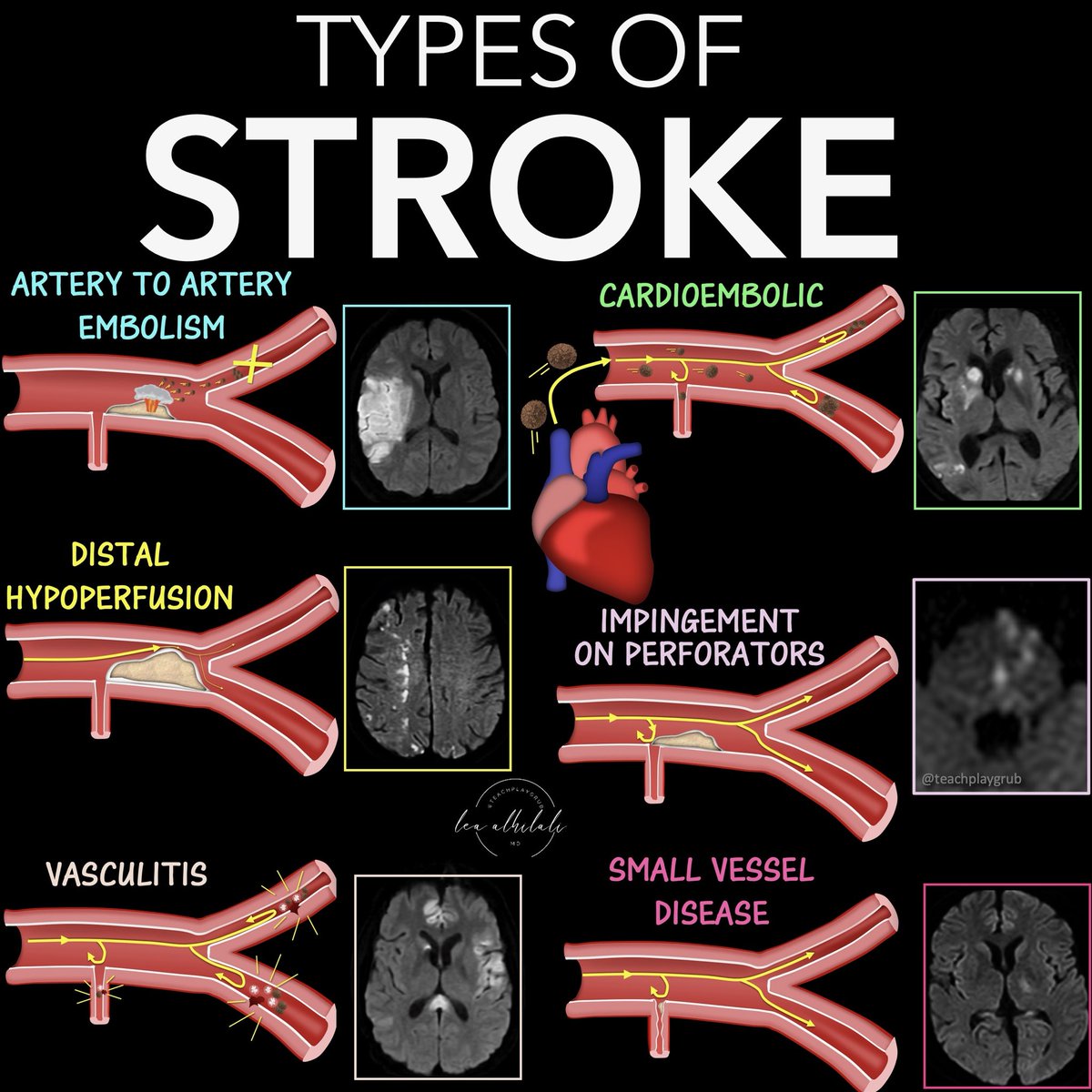 Lea Alhilali, MD tweet media