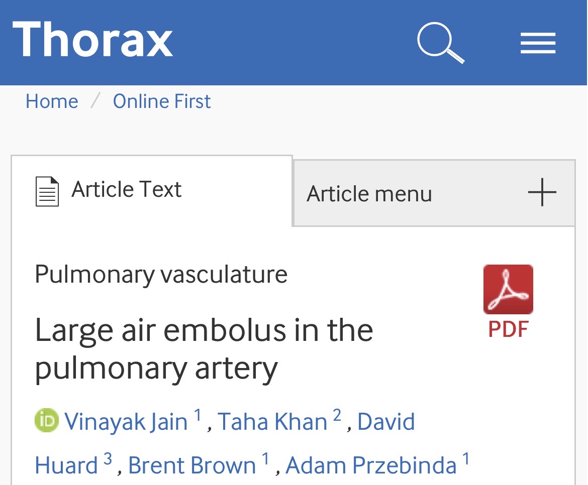 thevinayakjain's tweet image. One of the most intense rapid responses during my first year as an ICU fellow (rapid nurses &amp;amp; I still talk about it!) Check out the details of the case, now out in @ThoraxBMJ. #PulmCrit 

thorax.bmj.com/content/early/…