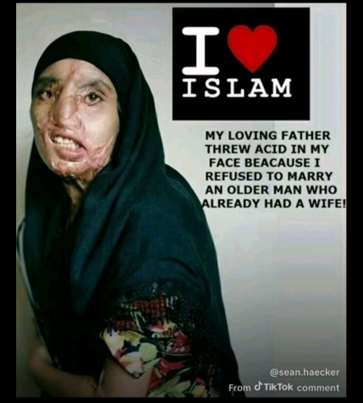 mixon_glen's tweet image. No. It's to hide the beatings they get