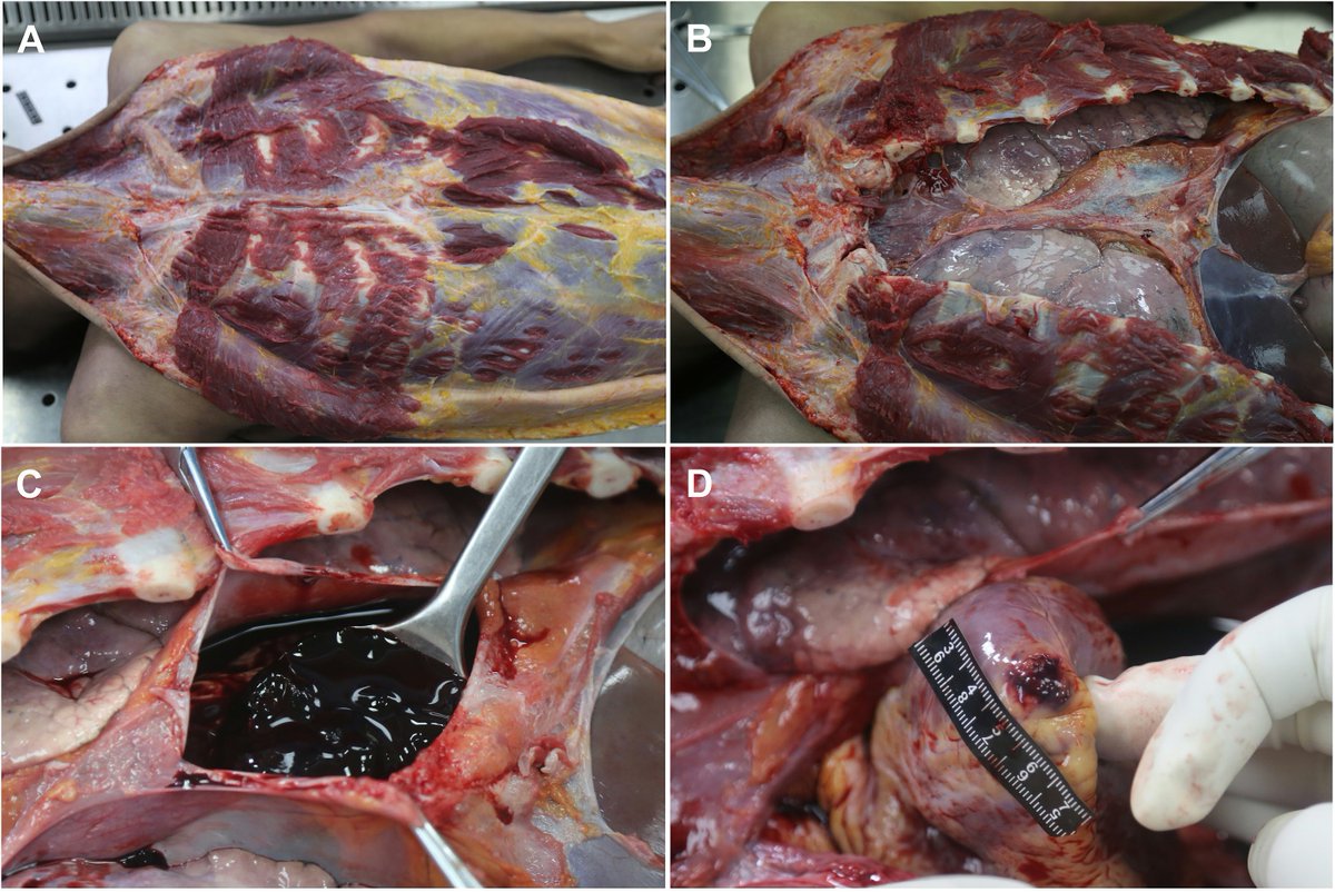 Forensic Sciences Research tweet media