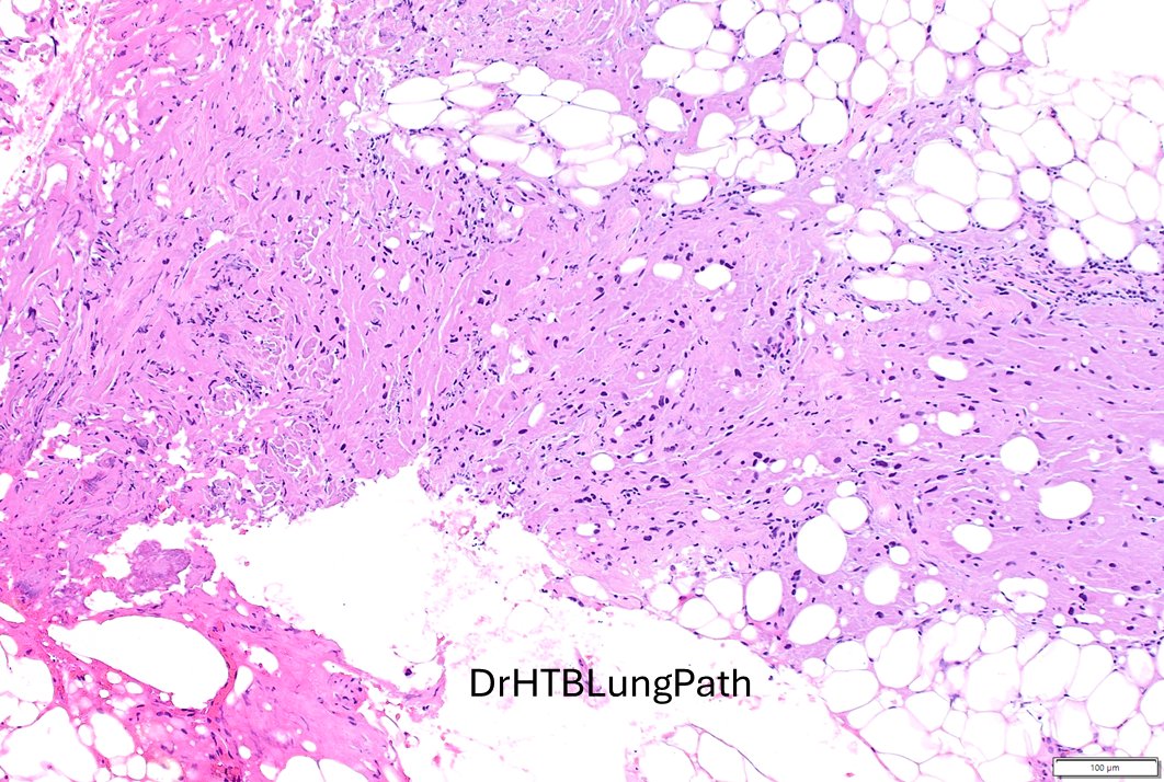 Humberto Trejo Bittar, MD, FCAP tweet media