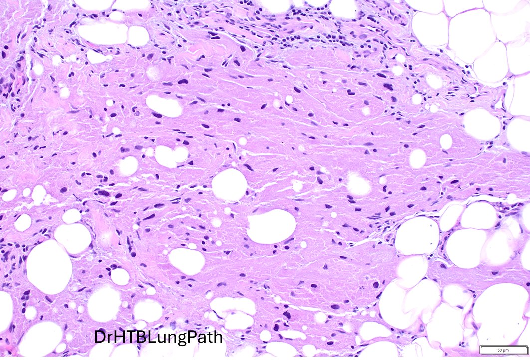 Humberto Trejo Bittar, MD, FCAP tweet media