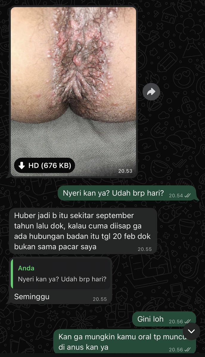 YangGwanSik15's tweet photo. Another case yg kita pun bingung. Awalnya nih cuma nyeri ambeyen seminggu lalu dan jd kek begini dalam semalam. Tp keukeuh riwayat terakhir diewe bulan september 2025. Stlhnya cuma tipis2. Kenapa sih mesti susah ngakuuuu biar aku tu gampang negakin diagnosanyaaa 😩 https://t.co/CARbNERPv5