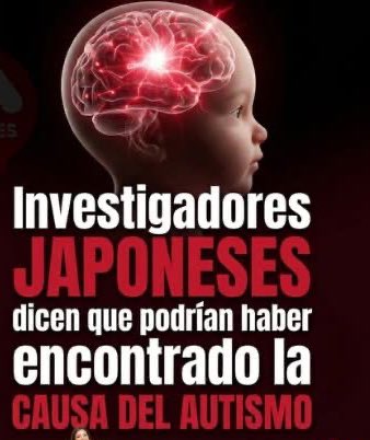 yudaffi's tweet photo. Un equipo de científicos de la Universidad de Fukui, Japón, estudió cómo ciertas sustancias derivadas de ácidos grasos presentes en la sangre del cordón umbilical al nacer podrían estar relacionadas con los síntomas del Trastorno del Espectro Autista (TEA) en la infancia. https://t.co/3Q4lAPnZR0