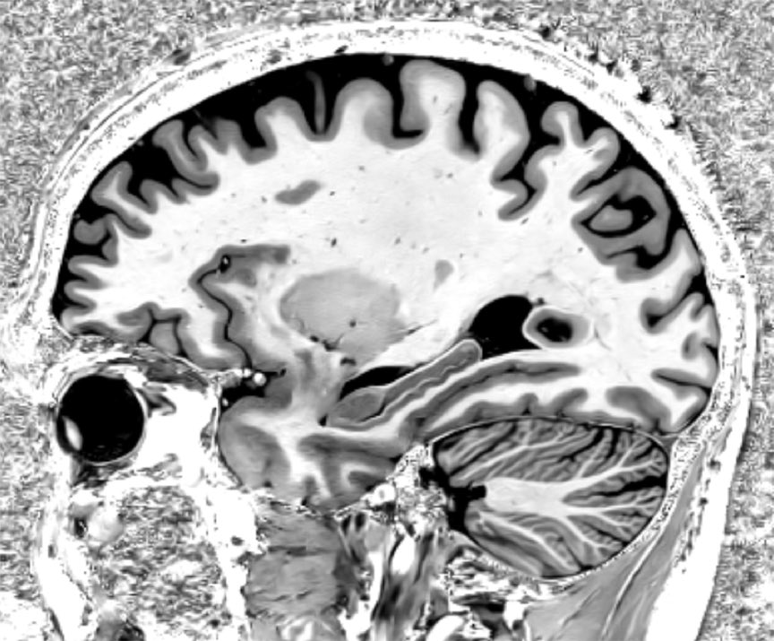 Erik Middlebrooks, MD tweet media