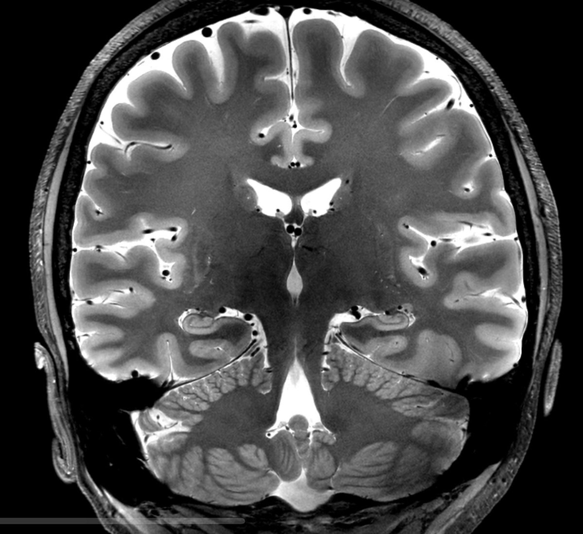 Erik Middlebrooks, MD tweet media
