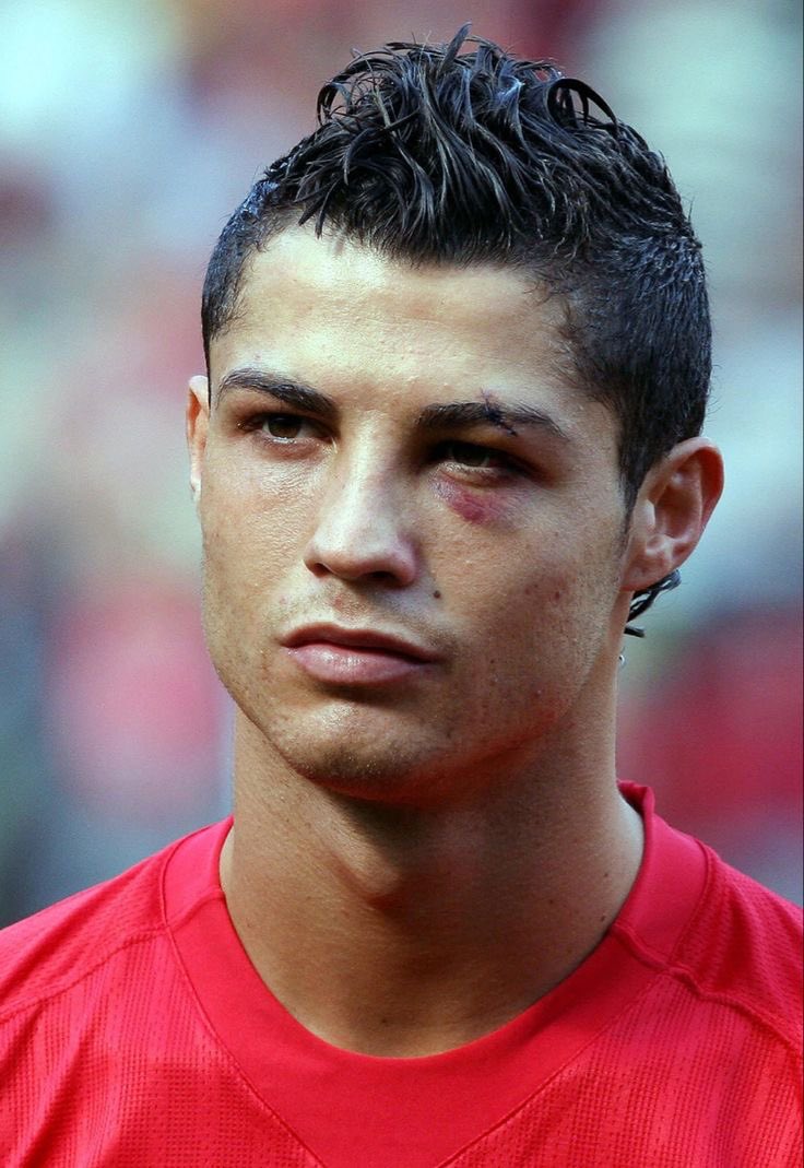 Recordemos que Eduardo CAMAVINGA se perdió el partido de ayer ante el Getafe por un DOLOR DE MUELAS.

Mientras tanto, Cristiano Ronaldo, fue a entrenar 2h después de sufrir un accidente automovilístico en el que estuvo apunto de PERDER LA VIDA.