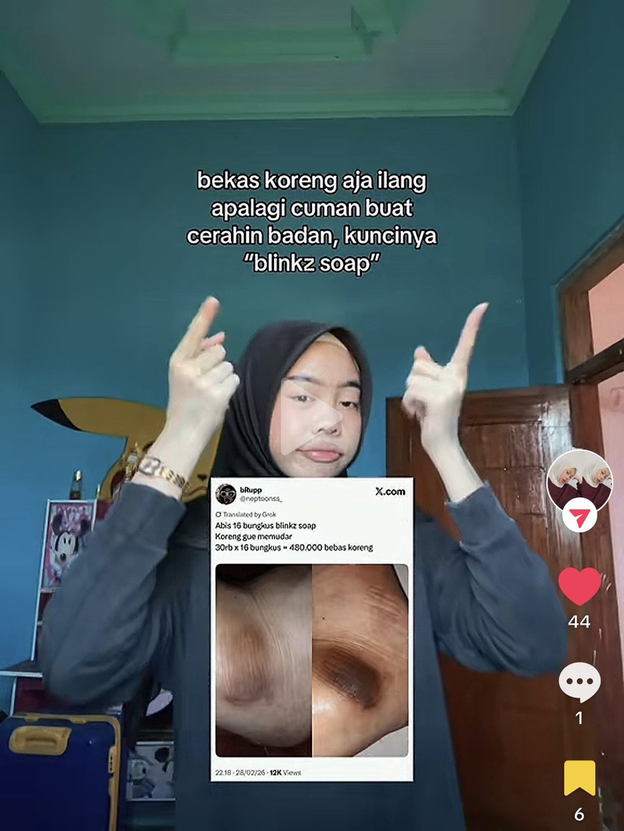 bRupp tweet media