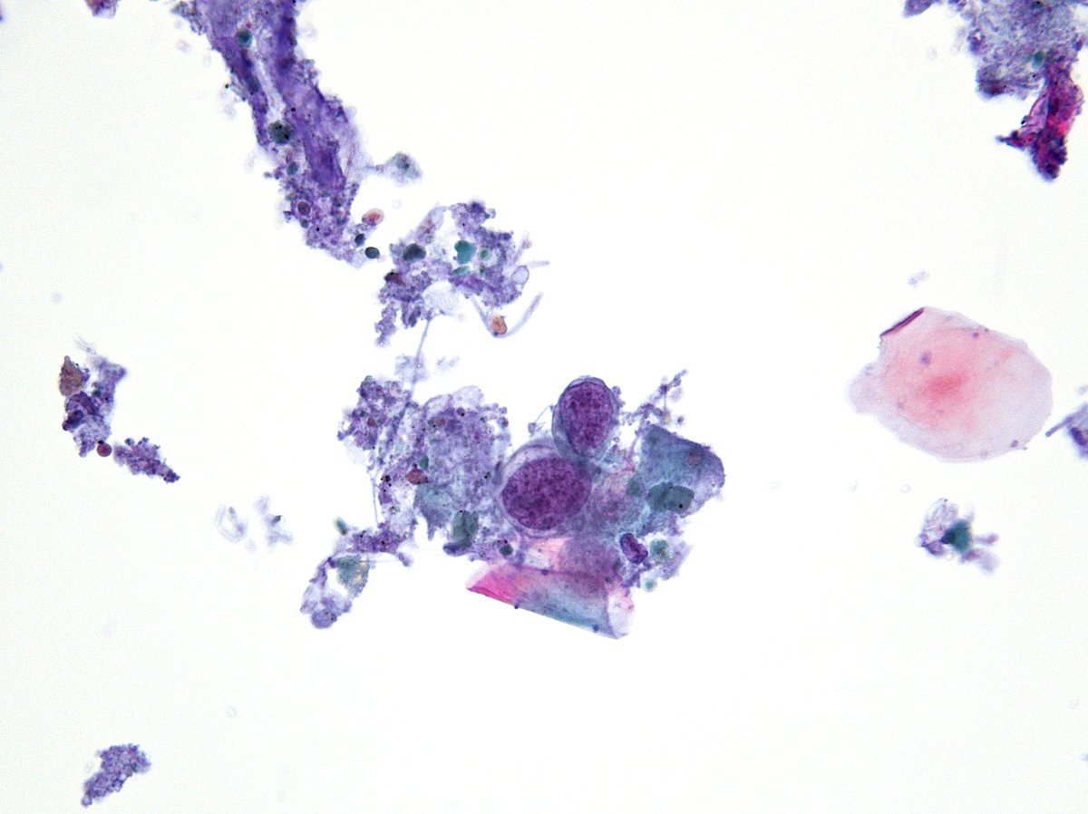 Syed Z. Ali tweet media