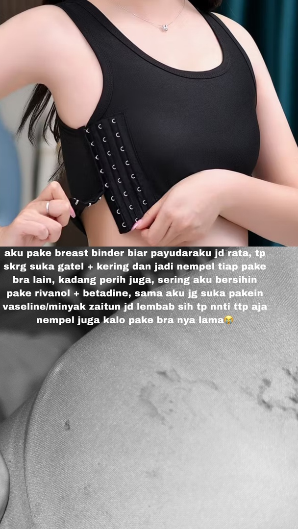 ✨OMBB | 🚫NO LINK tweet media