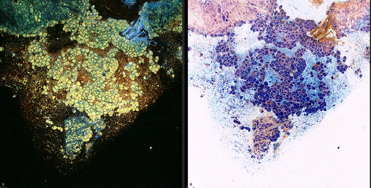 celltivity's tweet photo. We’re proud to partner with @ChristianaCare, the 1st health system in Delaware to use the Van Gogh™ Microscopy System in their advanced lung program. Thank you Dr. Ismael Matus &amp; Dr. Haroon Raja.
#MedTech #LungCancer #Pulmonology #CellTivity https://t.co/zYYpz1WqmK