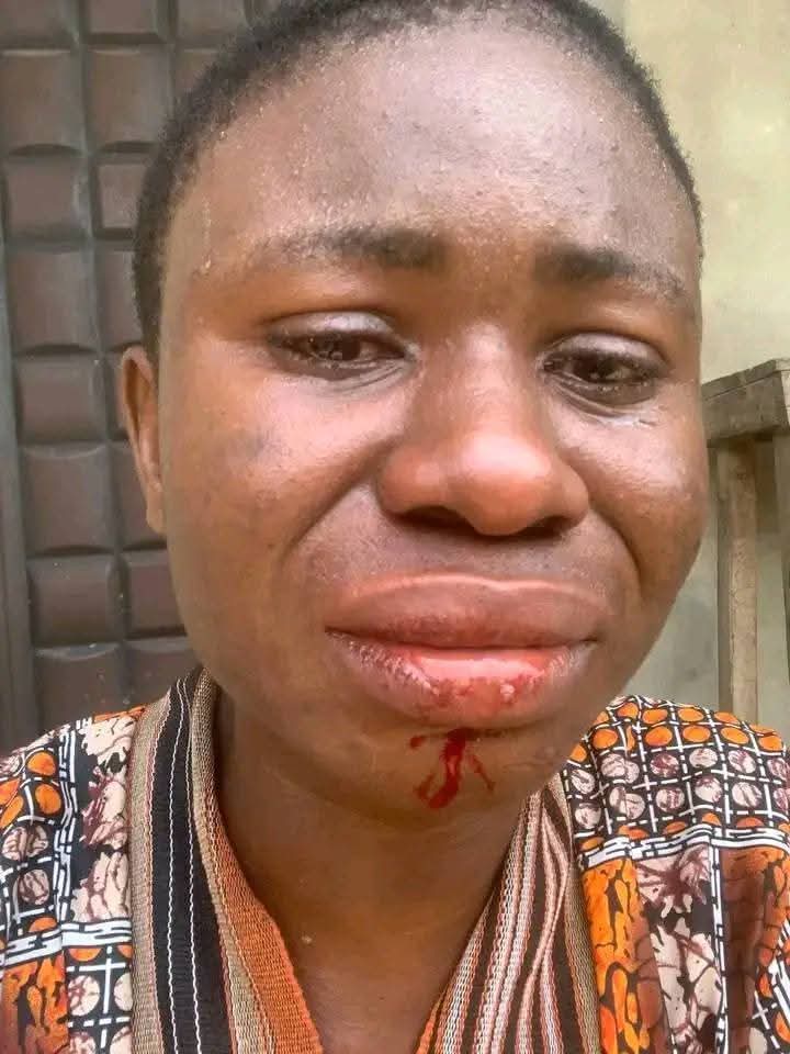 TodayFM951's tweet photo. #AreaTalk

Let's talk about drawing government attention to community needs, following the alleged assault on Miss Ogadinma Minnie Uchechi, by the Chairman of Ahoada West Local Government Area.

👉🏼 How best can people draw government attention to their needs in their areas? https://t.co/YoCrQdh0h8