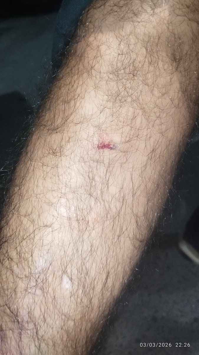 Raman_RTI's tweet photo. @Swiggy @SwiggyCares : Ur delivery parter #Sardar Damneet Singh ws bringing my #foodorder #231525266068140. Sadly, On the way from restaurant , a Street Dog bite him badly. Plz #Takecare of this young boy. Despite his #pain, he #respectfully delivrd his order. Respect. #Jammu https://t.co/SZglJaJMpg