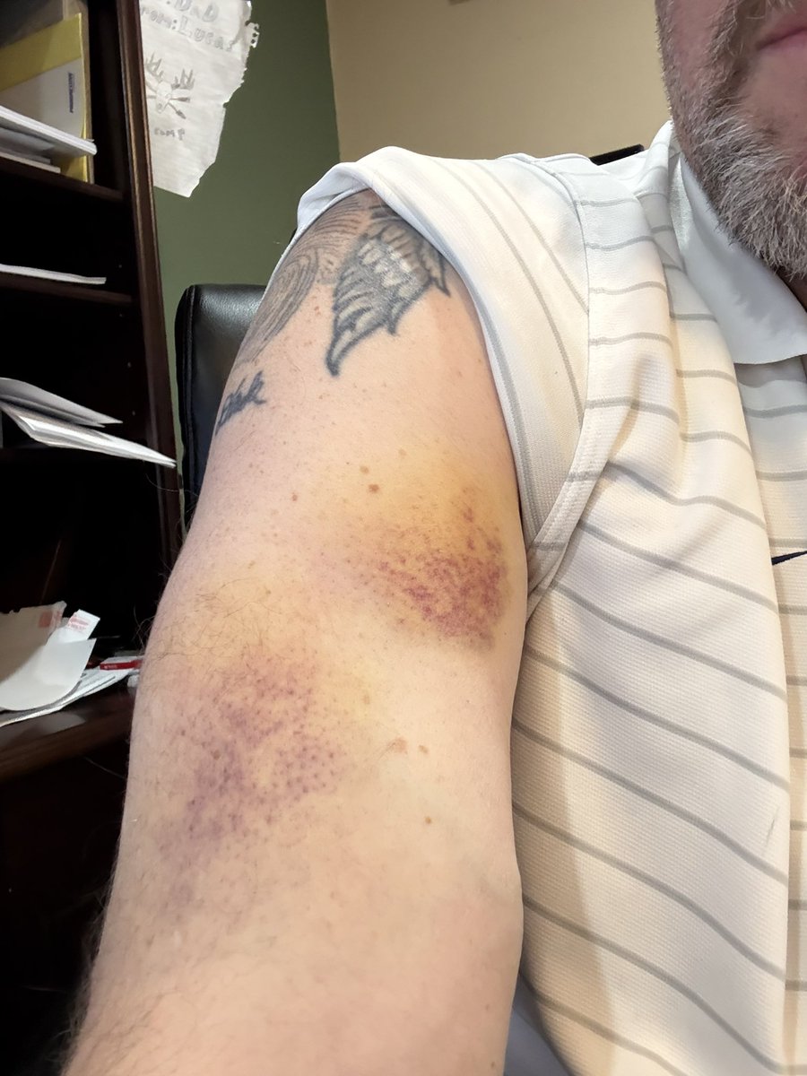 Steve Lendosky tweet media