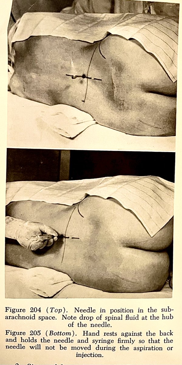 Merlin Larson, MD tweet media