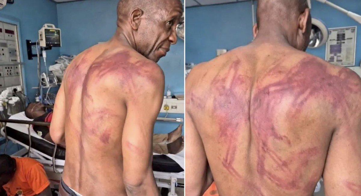 ChiombaCh1343's tweet photo. As citizens we have the right to fight for our constitution, for our rights. @edmnangagwa its time you stop this torture to activist and your time is up , you failed already there is no need to extend your term for only you and your people to benefit. #NoTo2030 #HumanRights https://t.co/k4H4sQsTy0