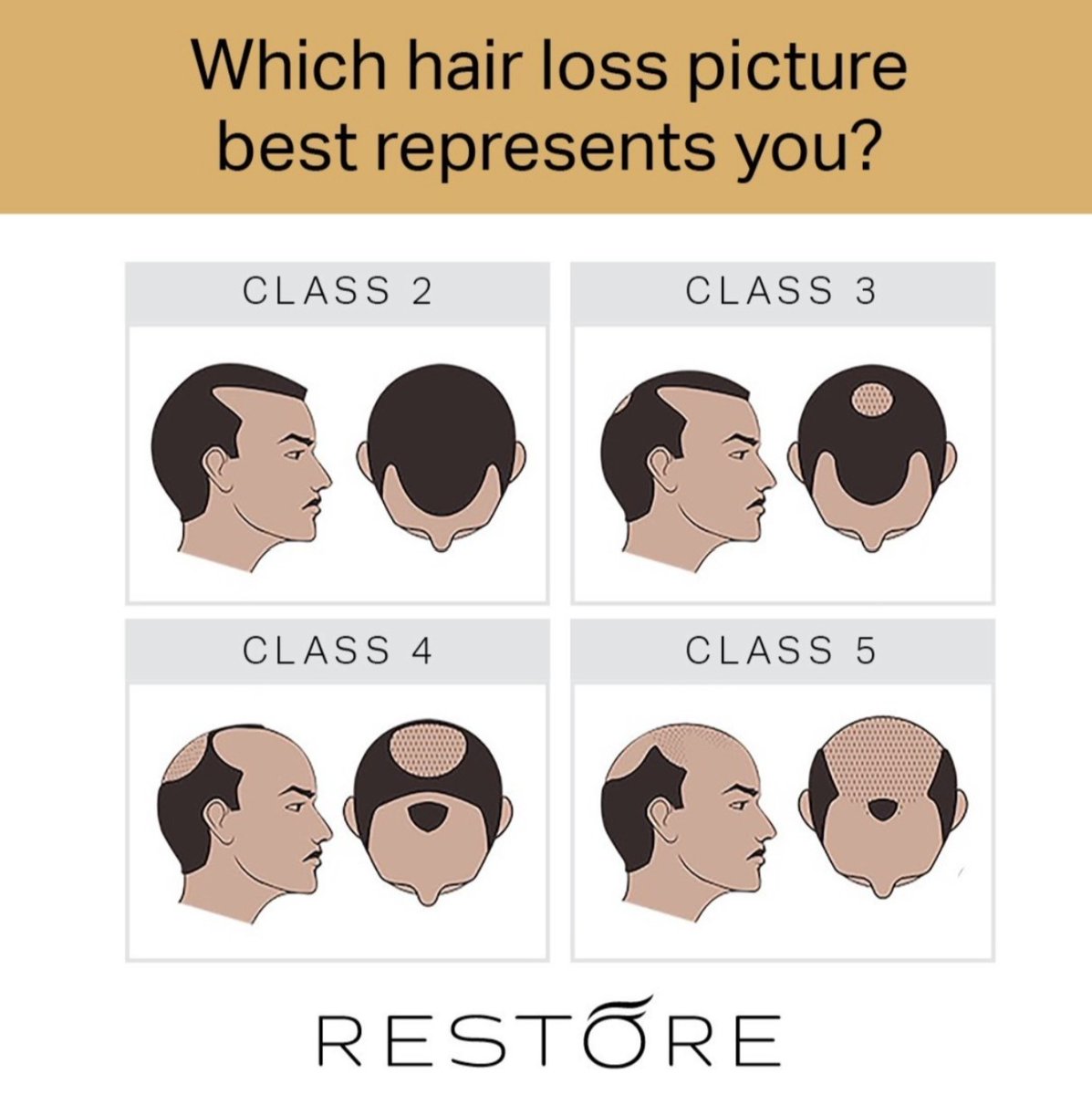 RESTORE Hair tweet media