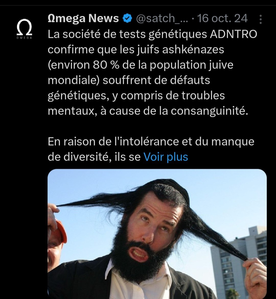 vanessakamel's tweet image. Toi va sucer des kiki de nouveau nés tas de #fdp #génocidaires #Cosangins