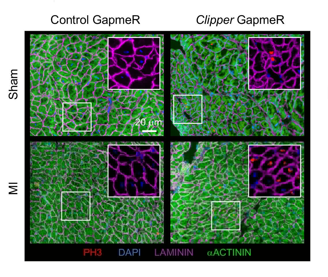 Circulation Research tweet media