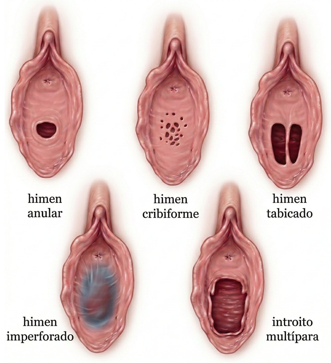 Hablemos seriamente de un mito antiguo que, por falta de información clara, sigue causando dudas innecesarias y dolor silencioso.

Muchos hombres imaginan el himen como una barrera sólida, pero la realidad anatómica es bastante diferente y más compleja.

Generalmente es un tejido