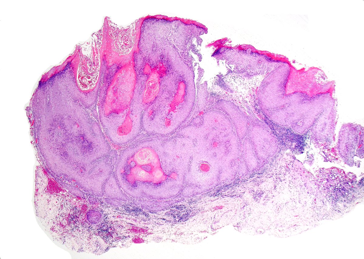 Andres Matoso tweet media