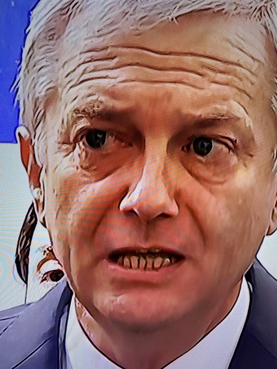 TheRipped_Utch's tweet photo. @marce_amalia Que asco de dientes tiene este viejo, seguro los tienes igual, vieja chota! https://t.co/yrUcQNctor