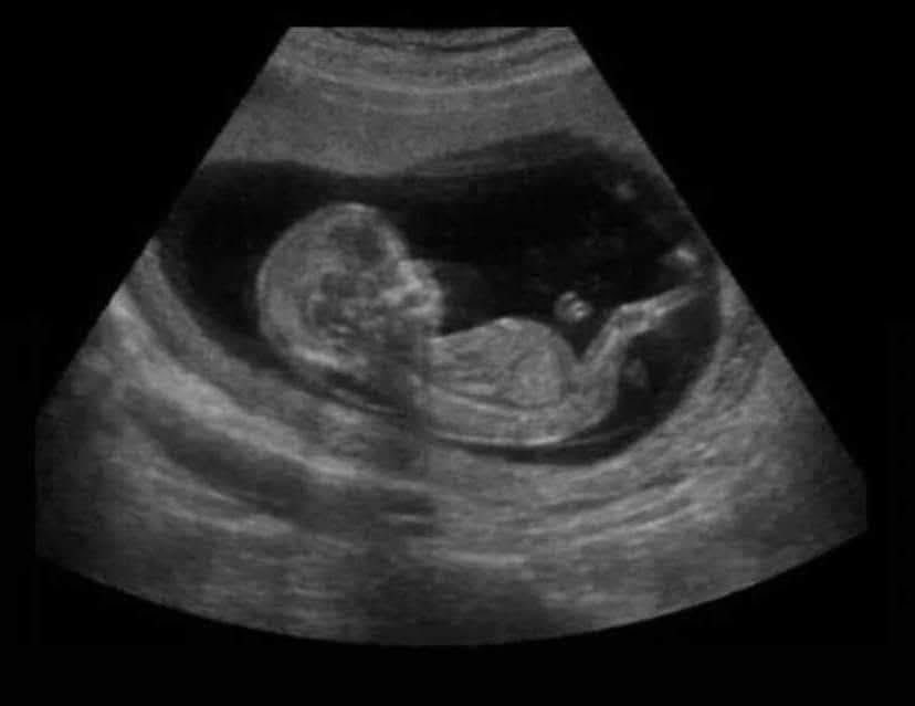 Una foto mía de cuando empecé a ser racista