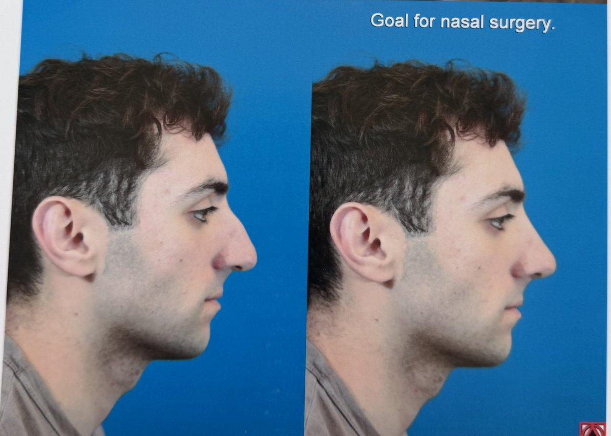 rasmr 🇱🇧 tweet media