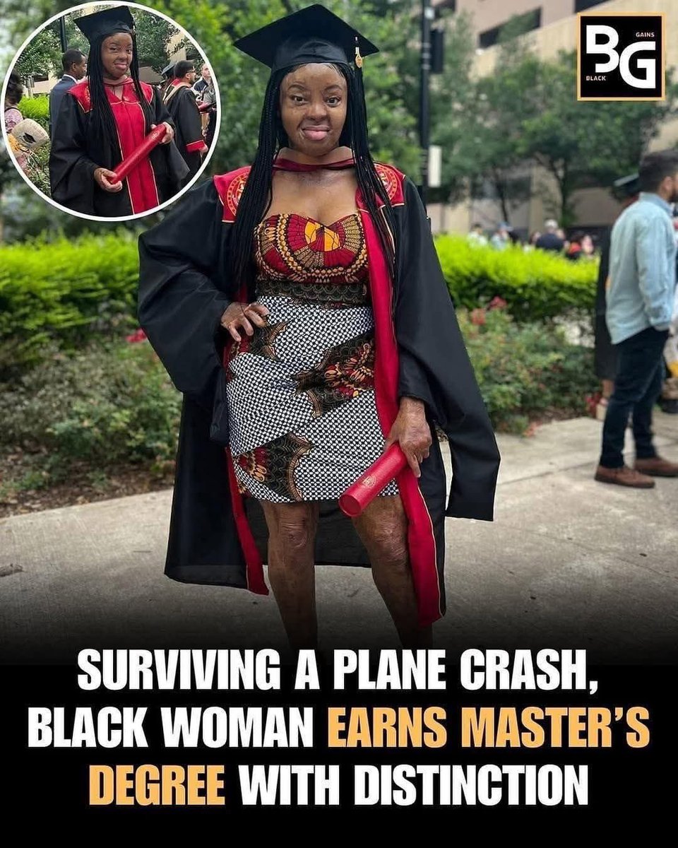 Nigerian lady Kechi Okwuchi, who survived a 2005 plane crash, earned her MBA with distinction, showing remarkable resilience.

Severely burned, she endured over 100 surgeries yet graduated at the top of her economics class.

Now a singer, consultant, and speaker, Okwuchi inspires