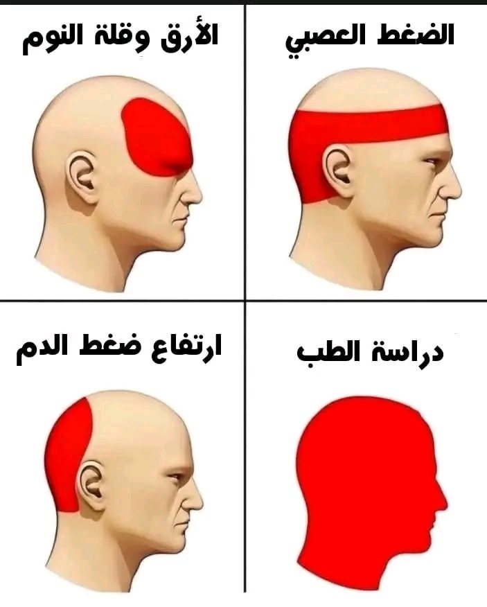 أسباب الصداع :