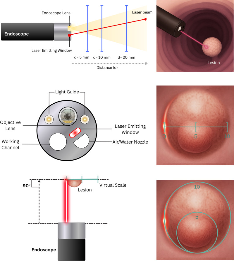 In Articles in Press: "Accuracy of Virtual Scale Endoscopy in colorectal polyp size measurement: Grading of Recommendations Assessment, Development and Evaluation–assessed pairwise and network meta-analysis" by Elgendy et al. giejournal.org/article/S0016-…

<a href="/DouglasAdlerMD/">Douglas G. Adler MD, FASGE, FACG, AGAF</a> <a href="/Babupmohan2/">Babu P. Mohan</a>