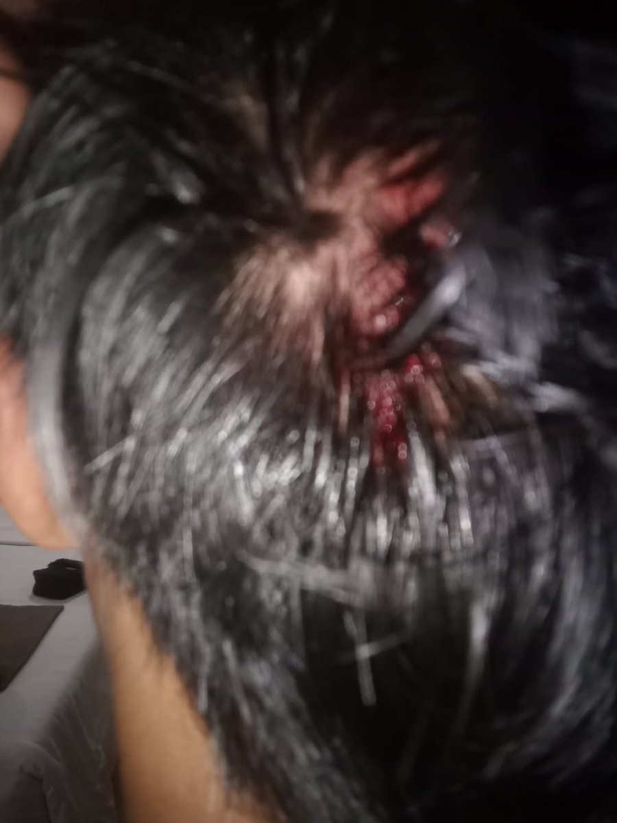 nyamuk malam tweet media