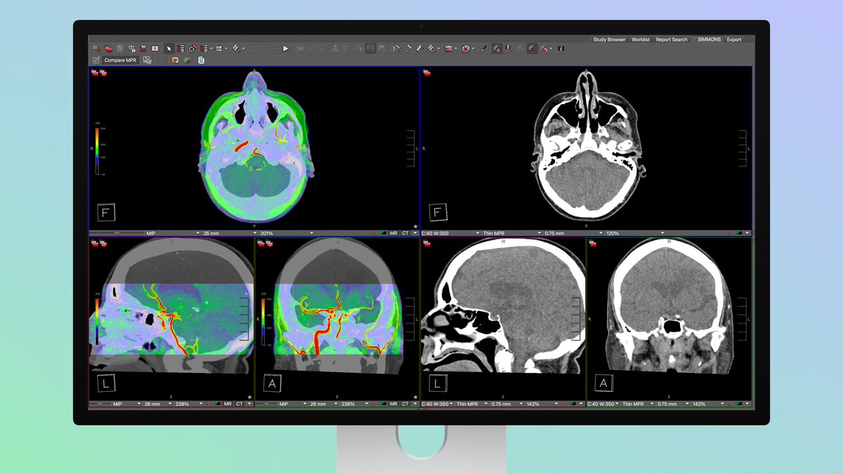 MacRumors's tweet photo. Apple's Studio Display XDR Supports DICOM Medical Imaging for Diagnostic Radiology https://t.co/VLfSshNYMo https://t.co/VBXVU43wdl