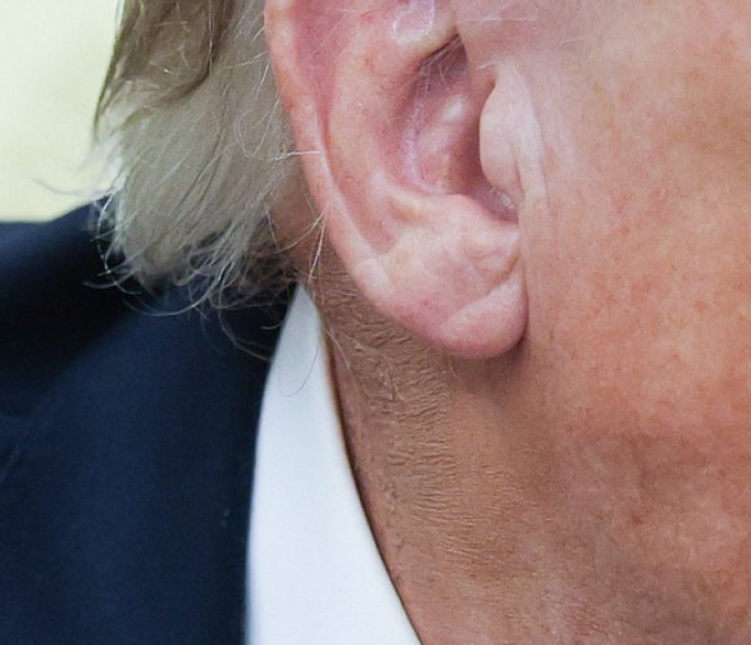 AlertesInfos's tweet photo. 🇺🇸 FLASH | Donald Trump a appliqué du maquillage pour masquer les rougeurs sur son cou. https://t.co/yHwzFBVJ0G