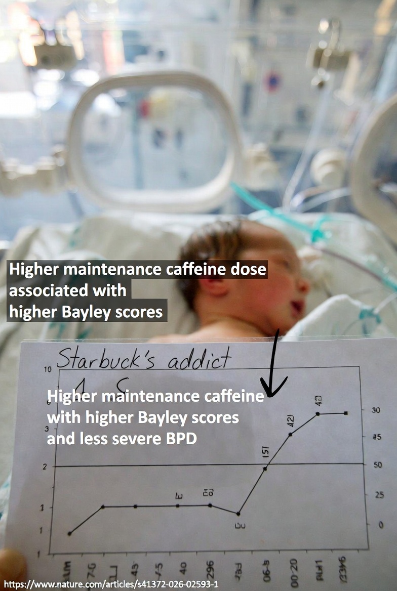 natetexsun's tweet photo. What does a Starbuck's addict and a premature baby have in common? The need for more caffeine. Higher maintenance caffeine dose associated with higher Bayley scores and less severe BPD. #NICU https://t.co/mTvsxOl7H2 https://t.co/tifWEZv7gQ
