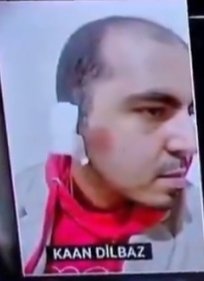 turkeygndm's tweet photo. Ankara'da güvenlik görevlisi Kaan Dilbaz, Etimesgut Ülkü Ocakları İlçe Başkanı Nuh Yurttakalan ve beraberindeki grup tarafından öldüresiye dövüldü.

Kanser hastası annesine bakan güvenlik görevlisi Kaan Dilbaz, şikayetçi oldu. 

(NOW TV - Yeşim Karacaoğlu) https://t.co/5Yp5qmt4yi