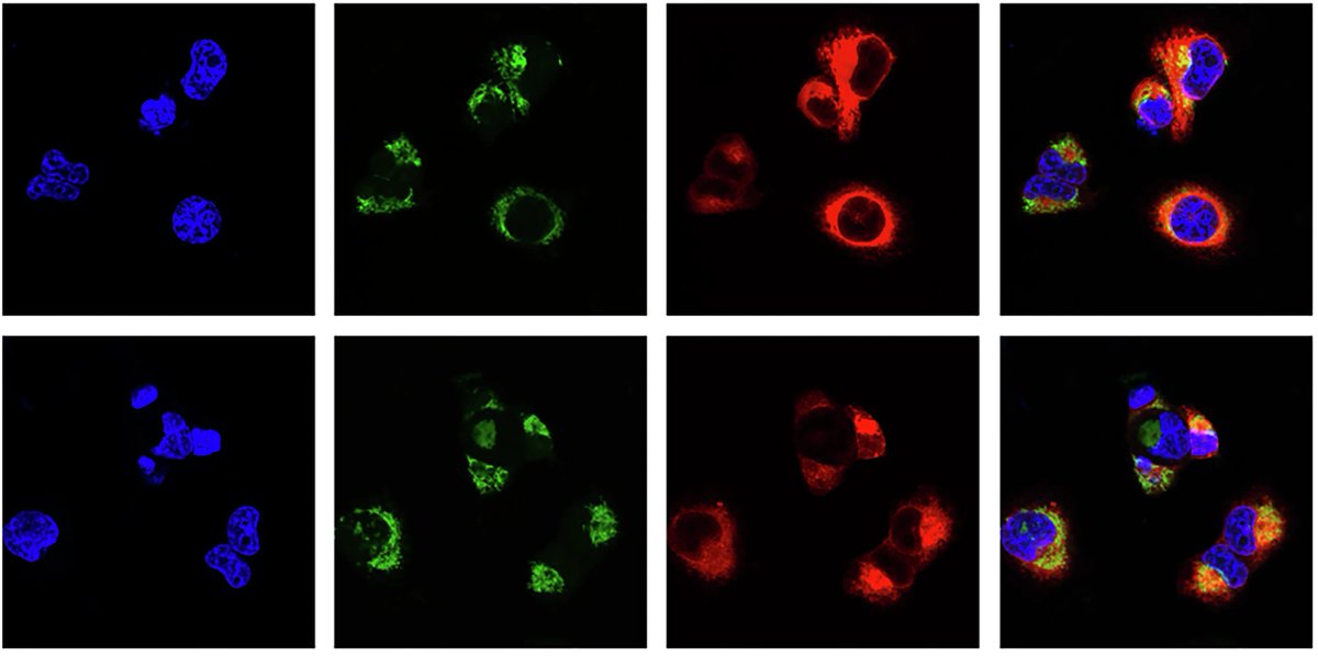 Prostate Cell News tweet media