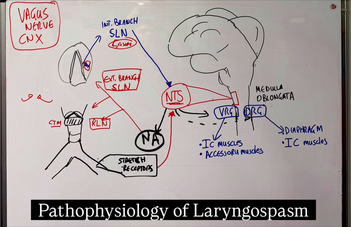 LeDyslexicMedic's tweet image. Coffee break session with the Specialist Critical Care Paramedics and the HART Team, focusing on the pathophysiology of laryngospasm and its management strategies.

@YorksAmbulance #criticalcare #fyp #medicaleducation #paramedic