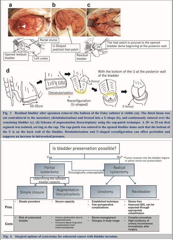 日本消化器外科学会 tweet media
