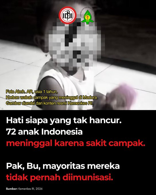 dosenkesmas's tweet photo. 🚨TRIGGER WARNING
Mindos mengucapkan turut berduka cita atas meninggalnya 72 anak Indonesia karena sakit campak.

Ga tega melihat anak anak yang harus menderita karena campak.

Kaum antivaksin kalau lihat twit ini silakan segera bertobat.

📽️ @idai_tweets https://t.co/8snXQ4tOTs