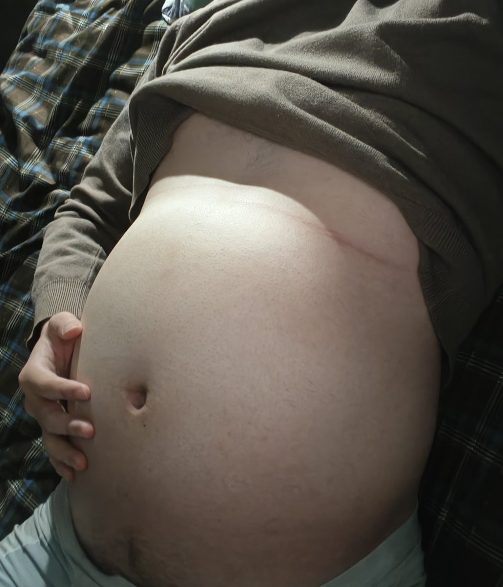 xifanganfan's tweet photo. So I fell asleep with a big belly.#bellyinflation #stuff #stuffbelly #gayinflation #撑大肚子 https://t.co/TYUVByAYsX