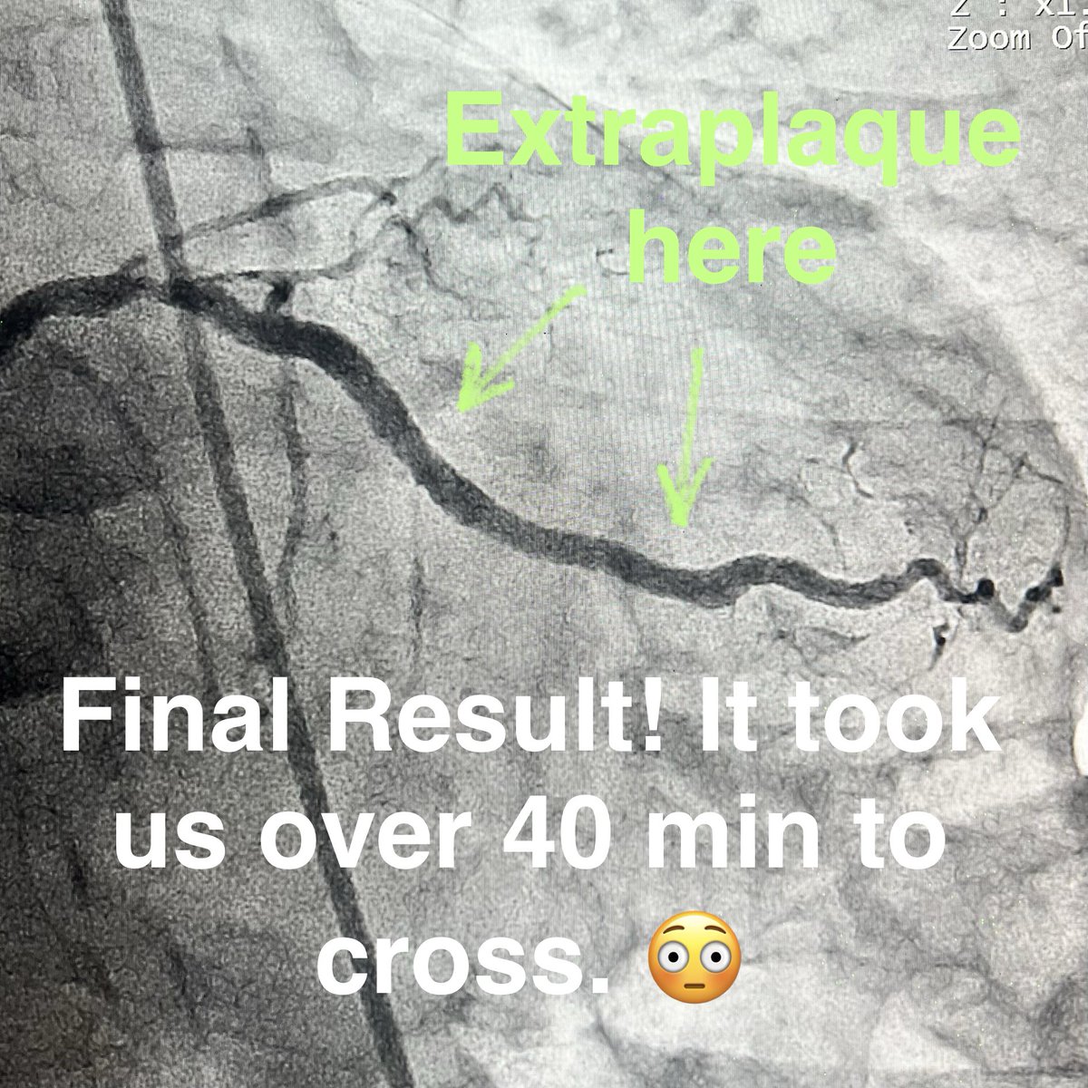 Salman Arain tweet media