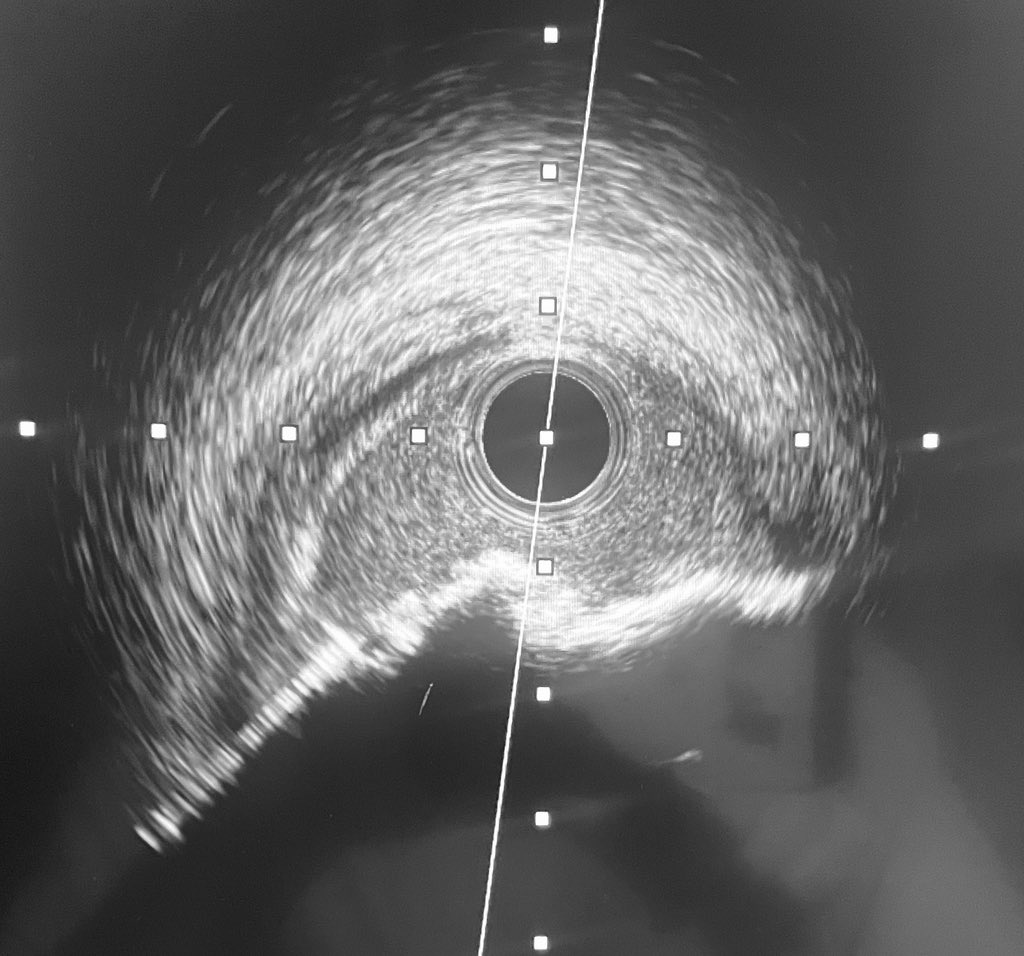 Umberto Barbero tweet media