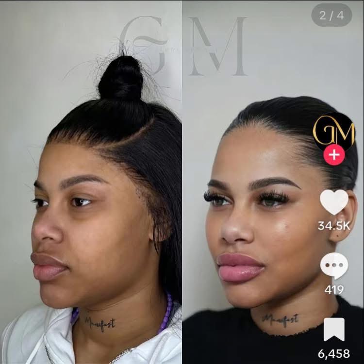 Mellow Rackz Child Before and after photos of Mellow Rackz surface
